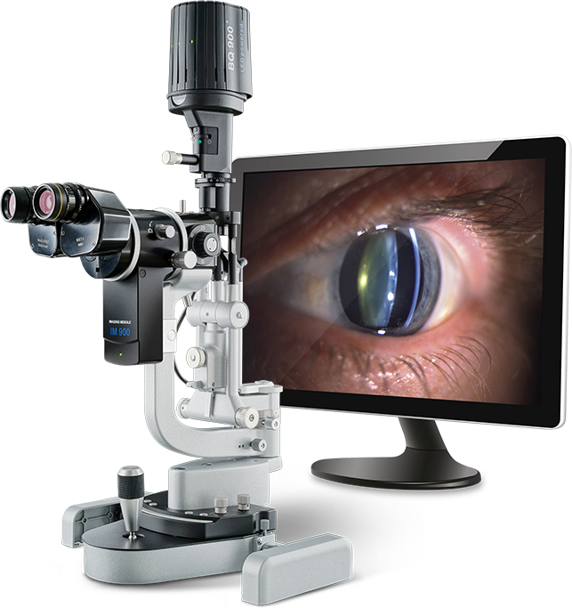 slit-lamp-monitor